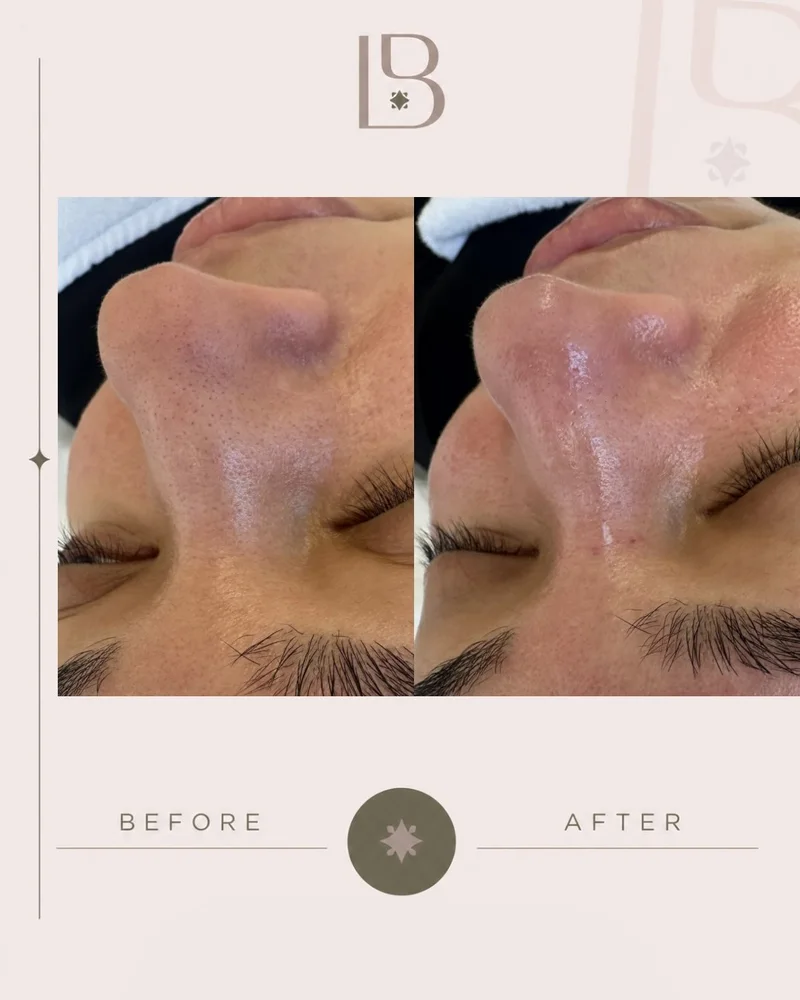 Before and after facial treatment, close up